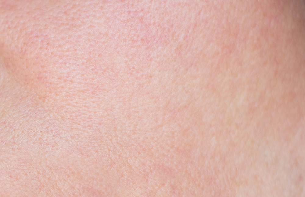 Nahaufnahme von normaler Haut mit leichten Poren.